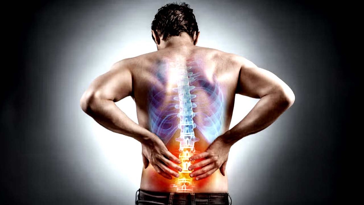Persistent Back Pain Could Signal Rare Ankylosing Spondylitis Experts Warn