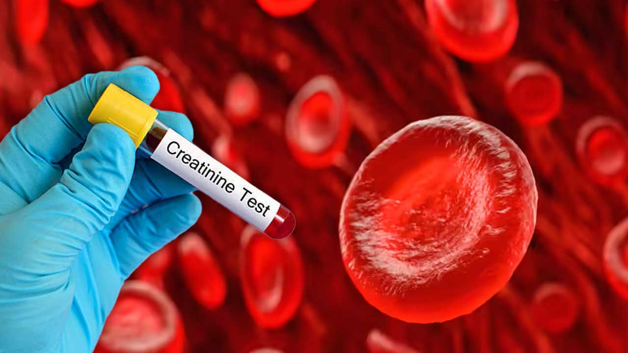 Diabetes and High Creatinine: Does It Always Mean Kidney Failure?